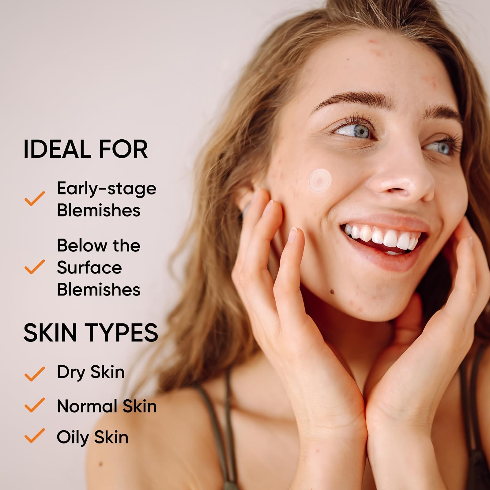 Large Hydrogel Acne Patches Xl - Xl Skincare 评论和价格