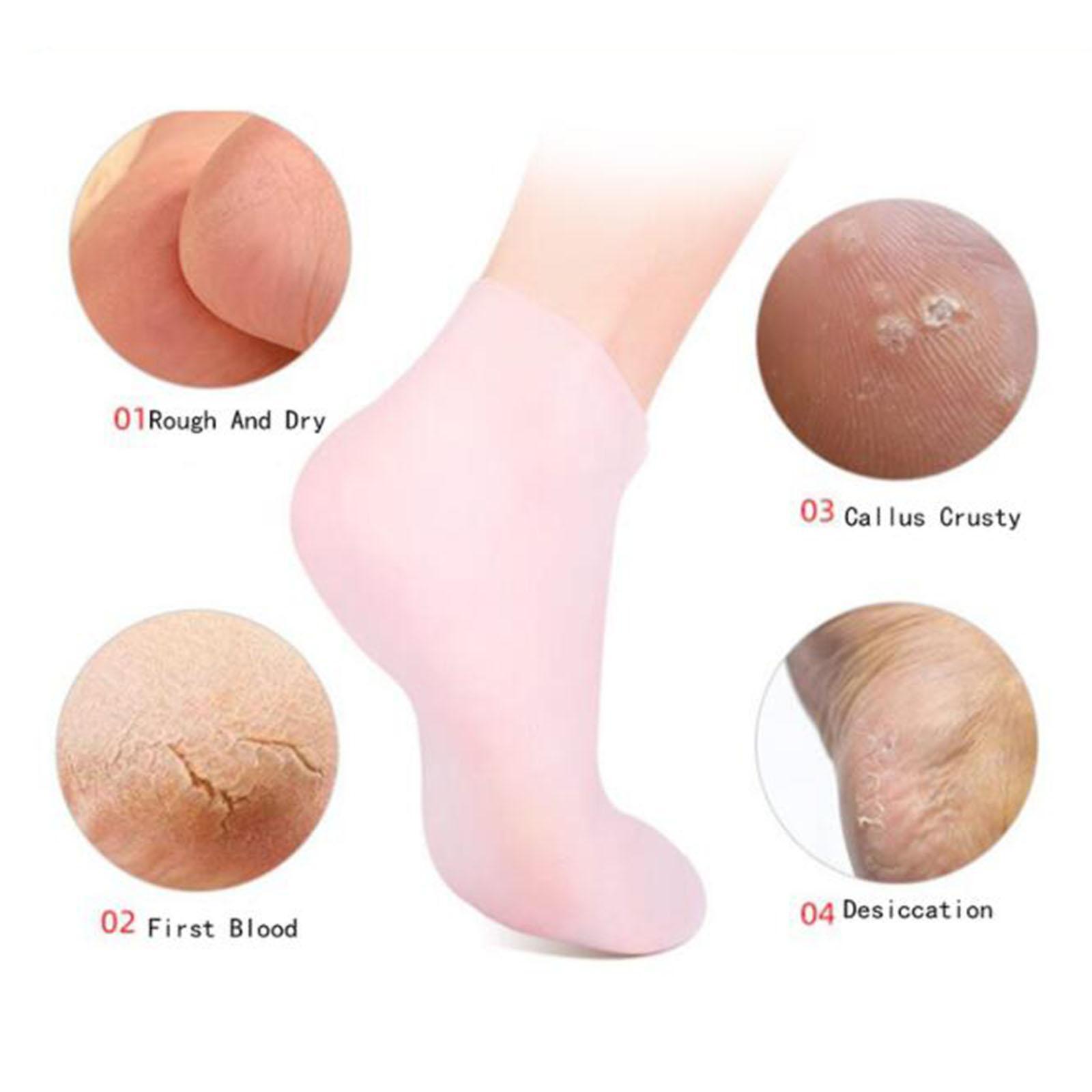 Soft Silicone Gel Socks Toe So - Xl Skincare 评论和价格